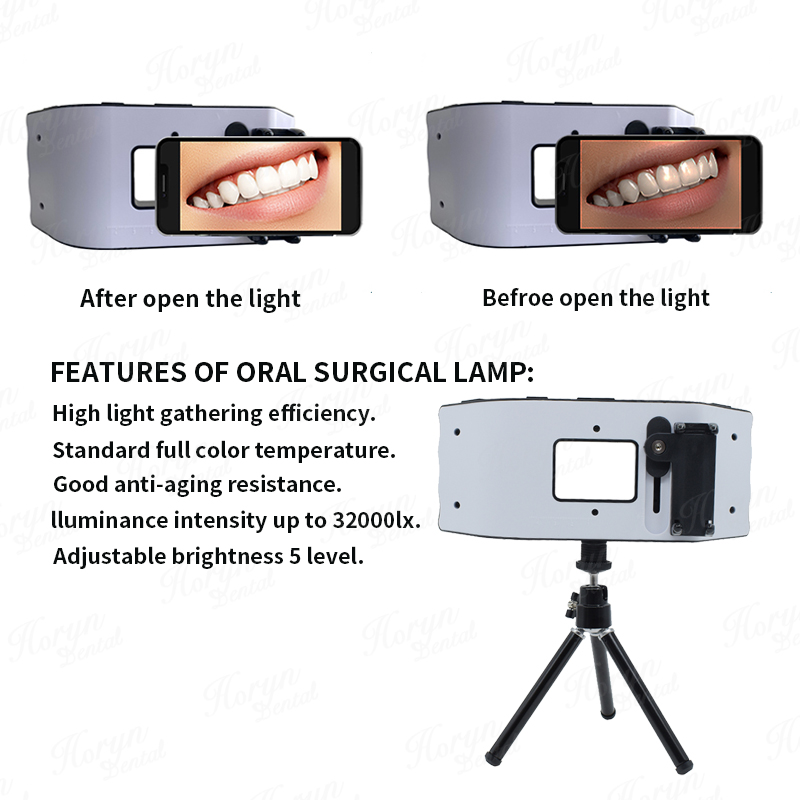 Dental Flash Light Photography - Photography Lighting Flash 评论和价格